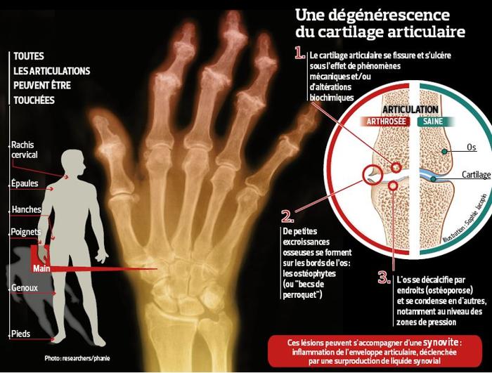 «Une douleur à la main ne doit pas être prise à la légère»