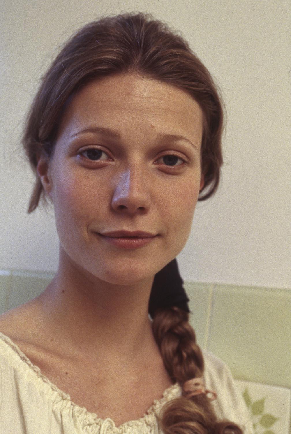Les taches de pigment des boutons sur la personne de la photo