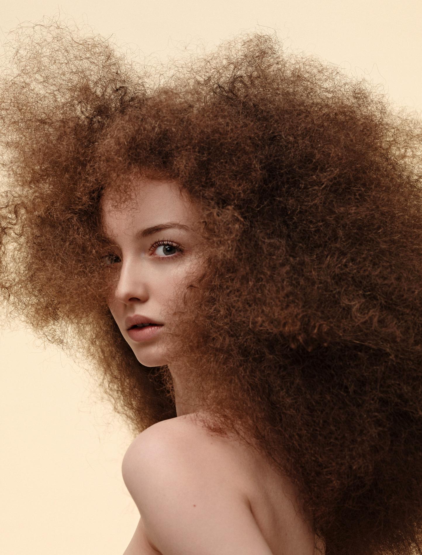 22 ans ont commencé à tomber les cheveux