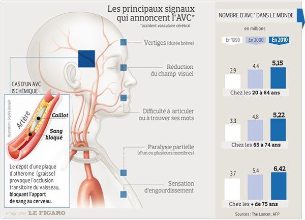 Avc Les Symptômes Qui Doivent Faire Appeler Le 15