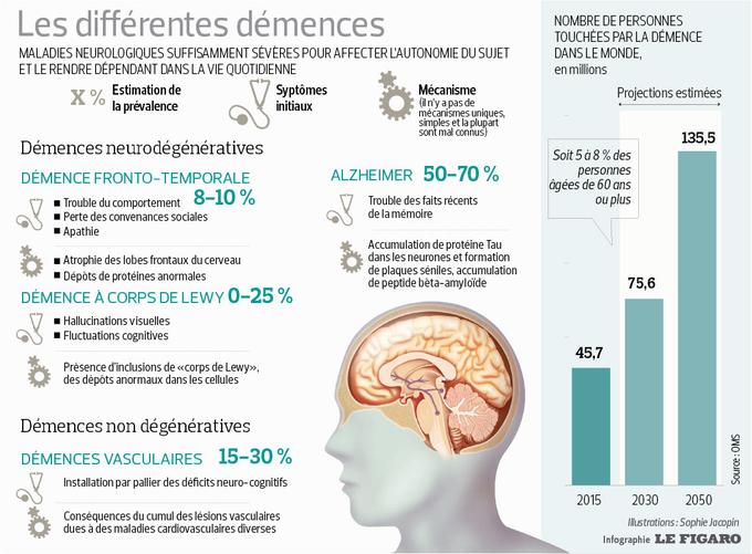 Alzheimer - Autres Démences ? - Fiches Santé Et Conseils Médicaux