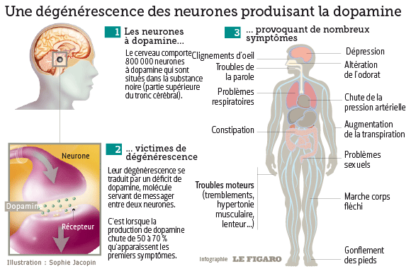 Maladie De Parkinson : Des Promesses De Progrès