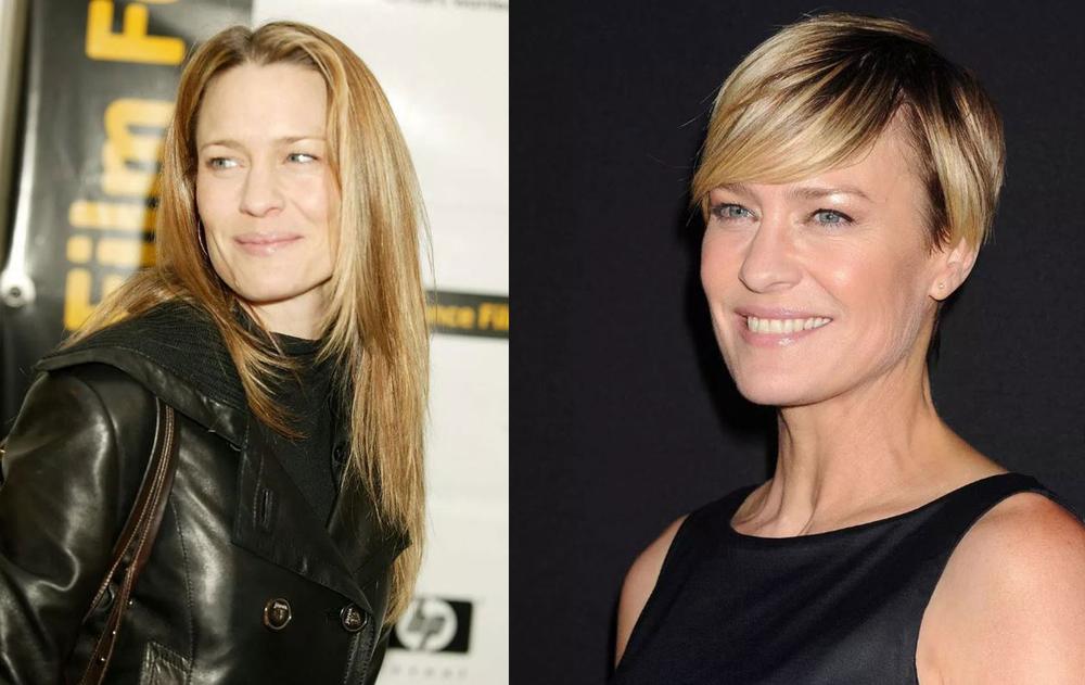 Crâne rasé, Emma Stone dévoile sa transformation la plus radicale