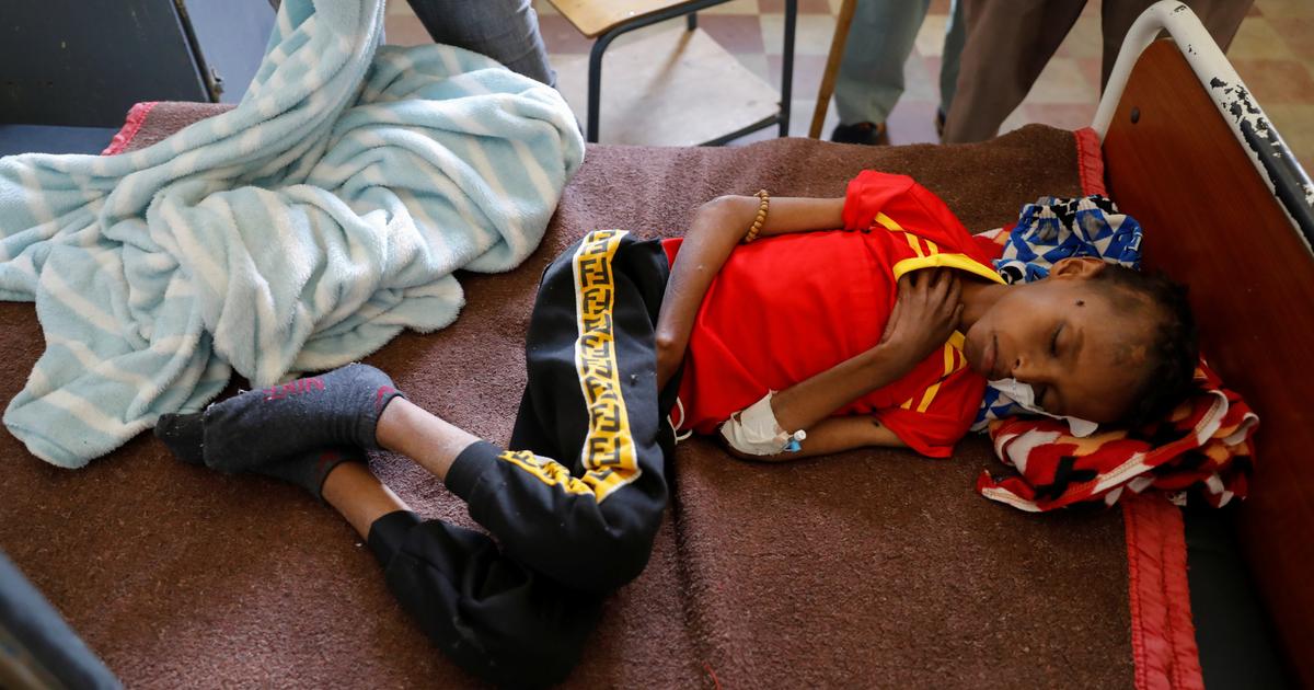 Éthiopie: 30.000 enfants risquent de mourir au Tigré en proie à la famine, alerte l'ONU