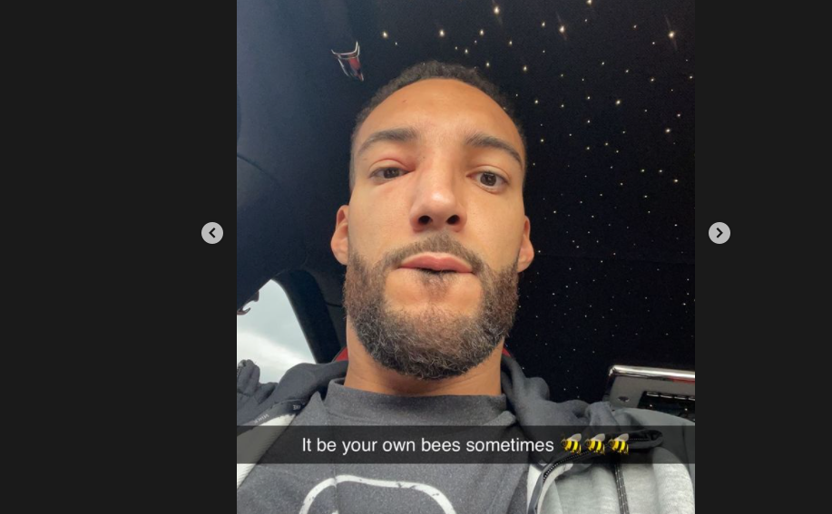 Gobert stung… by one of his own bees before a decisive game against Dallas