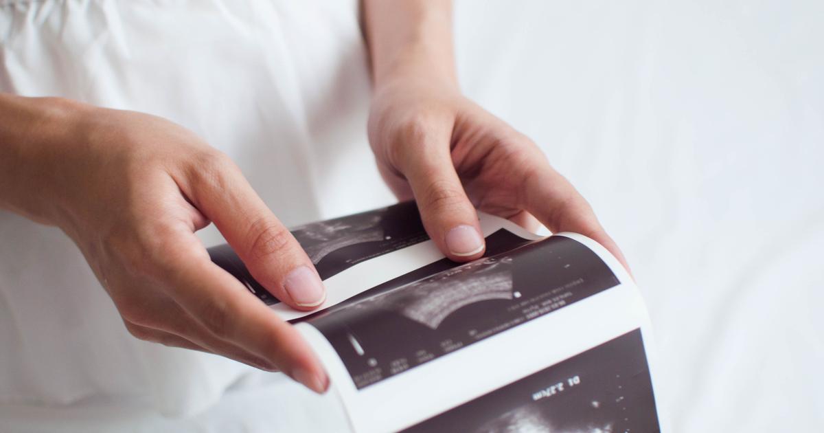 Troublantes et extrêmement rares : les grossesses superfœtatoires, ou quand on tombe enceinte alors qu'on l'est déjà