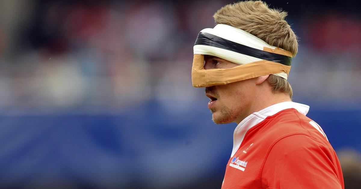 Coupe du monde de rugby: Dupont masqué après son opération ? Qui sont ces joueurs à avoir joué avec un masque
