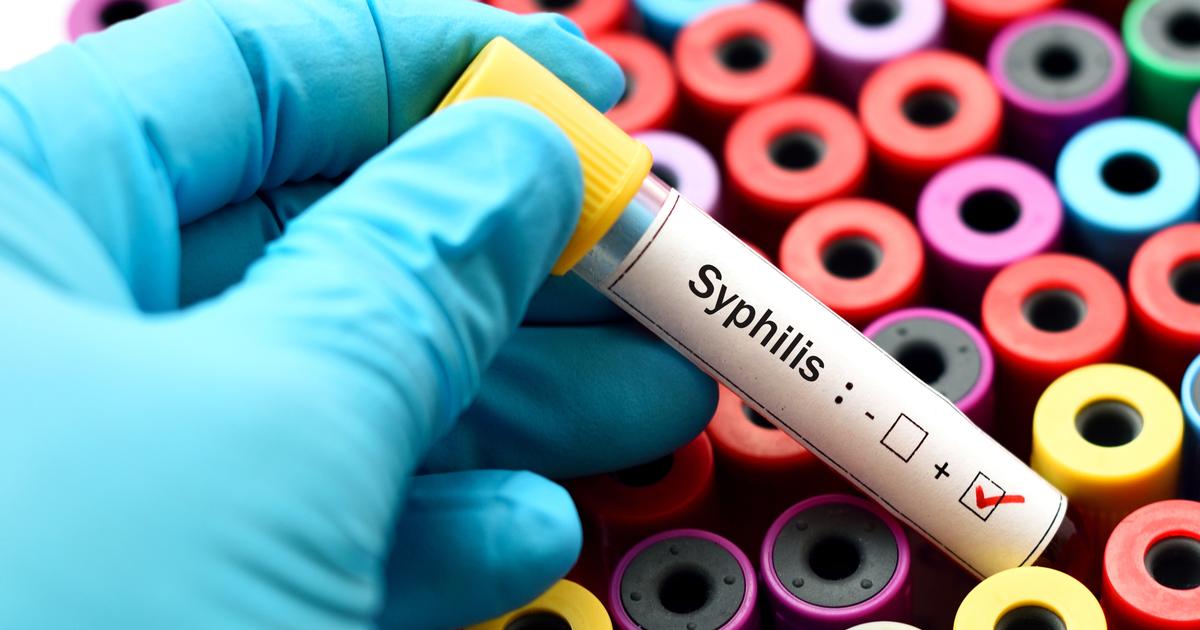 Allarme sull’aumento dei casi di sifilide nei neonati