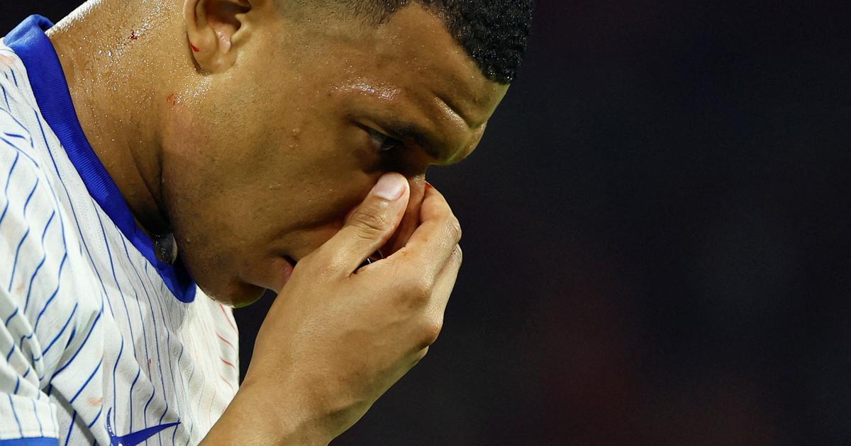 Regarder la vidéo Euro 2024: fracture du nez confirmée, Kylian Mbappé regagne le camp de base de l'équipe de France