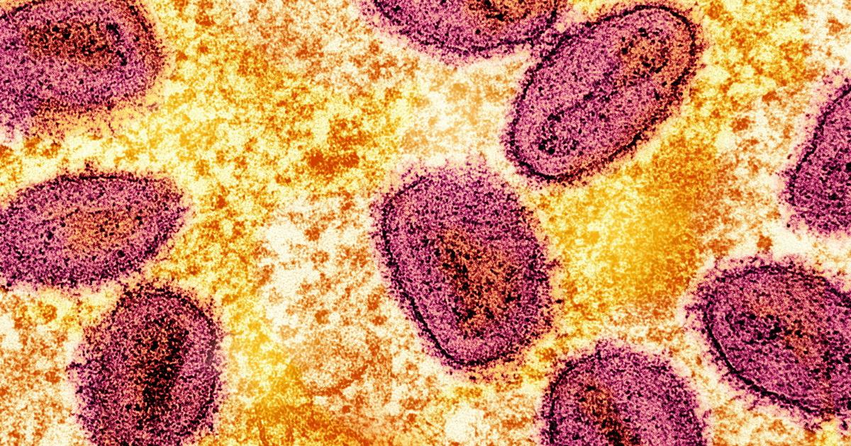 Mpox : l’Organisation mondiale de la santé maintient son plus haut niveau d’alerte