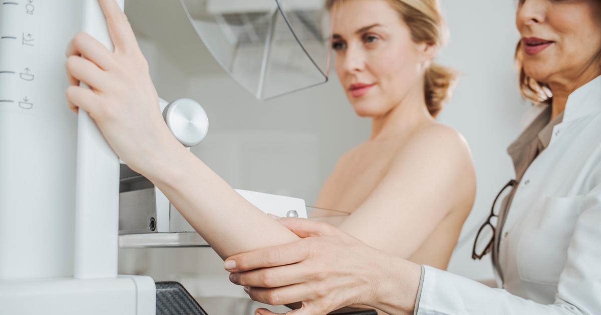 Faut-il abaisser l’âge de dépistage du cancer du sein avant 50 ans