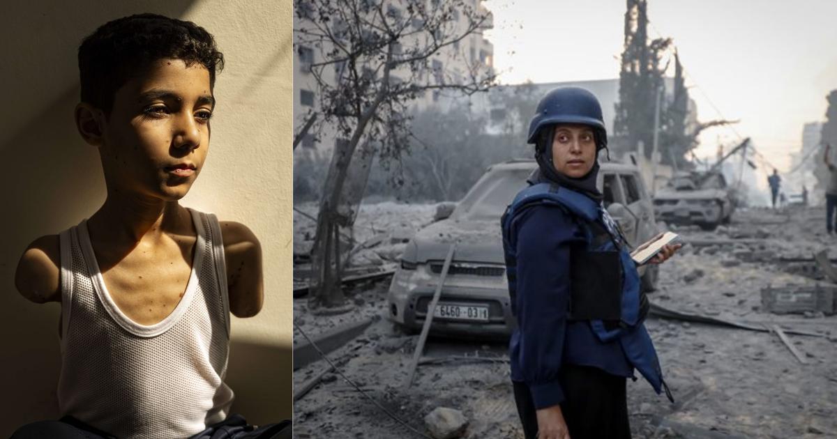 Le cliché d'un enfant palestinien amputé consacré par le World Press Photo 2025