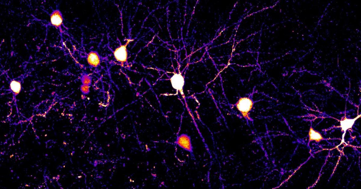 Human Neuron Complexity Revealed