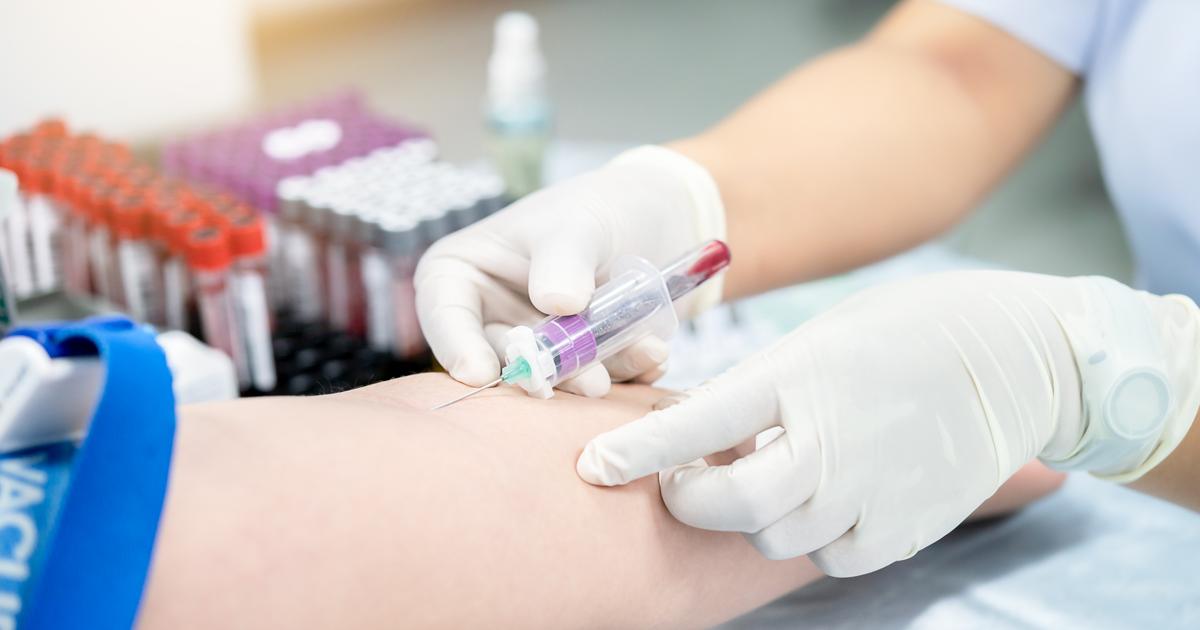 Cancer : une simple prise de sang pour débusquer plus tôt la récidive et adapter le traitement