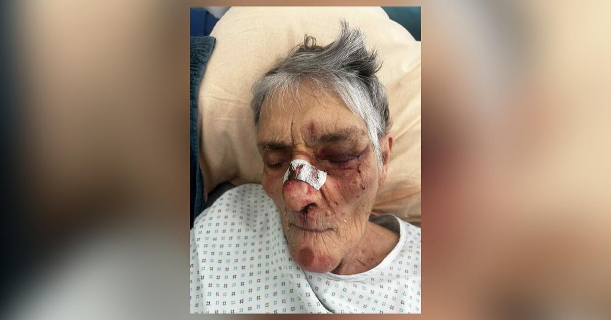Â«Elle tremblait de la tÃªte aux piedsÂ»Â : prÃ¨s de Marseille, un Ehpad accusÃ© de...