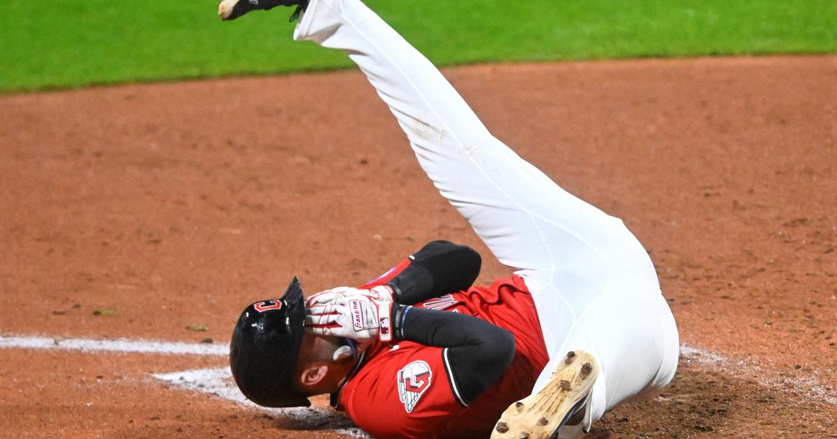 Balle reÃ§ue dans le visage Ã  160 km/h, stupeur dans le stade... Un joueur de baseball...