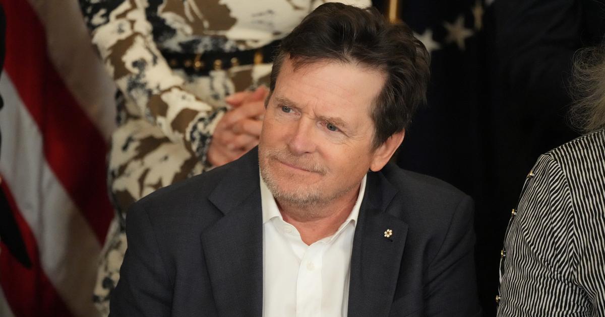 “Je me suis brisé tellement d’os” : Michael J. Fox ne veut plus marcher, ses bouleversantes confidences sur la maladie