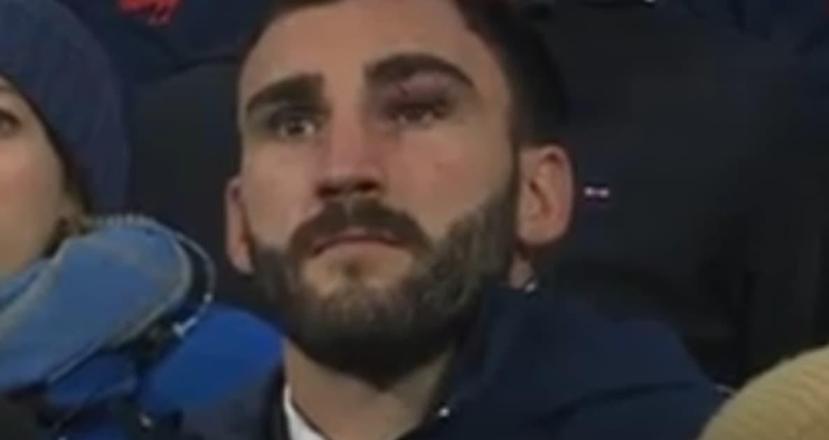 XV de France : «Honteux», polémique après le violent choc au visage subi par Ollivon non sanctionné