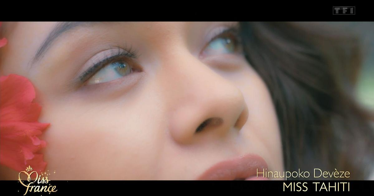 Miss France 2026 : Hinaupoko DevÃ¨ze, lâ€™imperfection assumÃ©e