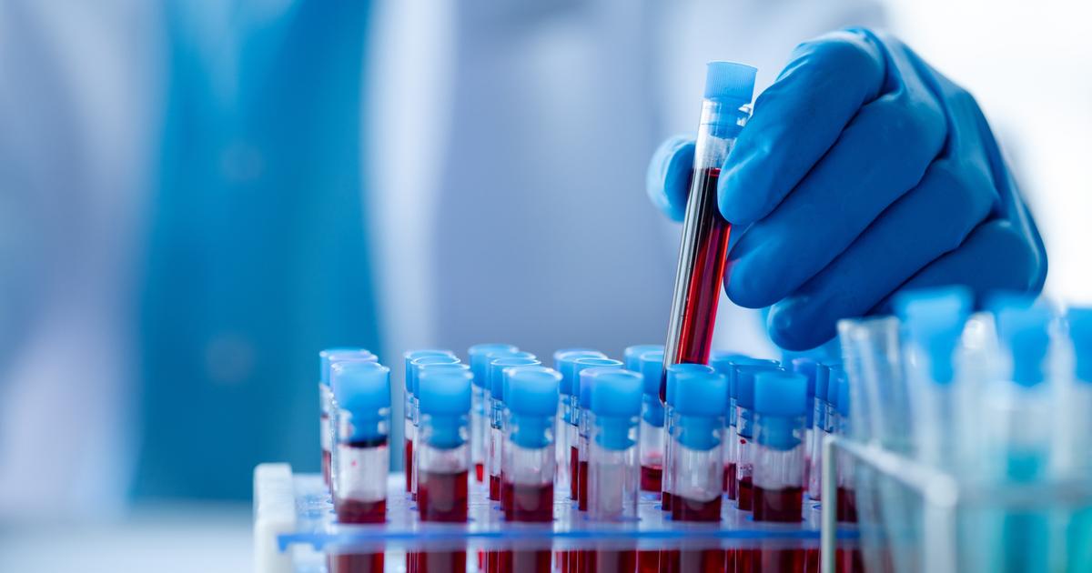 Contre le vieillissement, rajeunir notre sang en «assouplissant» nos cellules souches