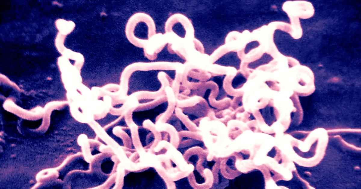 La découverte d’une bactérie vieille de 5500 ans relance le débat sur les origines de la syphilis