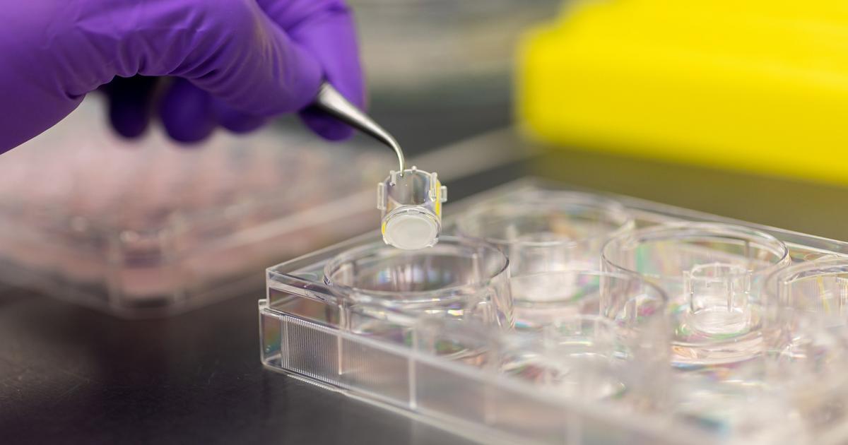 Episkin Mesh Dans les coulisses d’Episkin, le laboratoire de L’Oréal qui fabrique de ...
