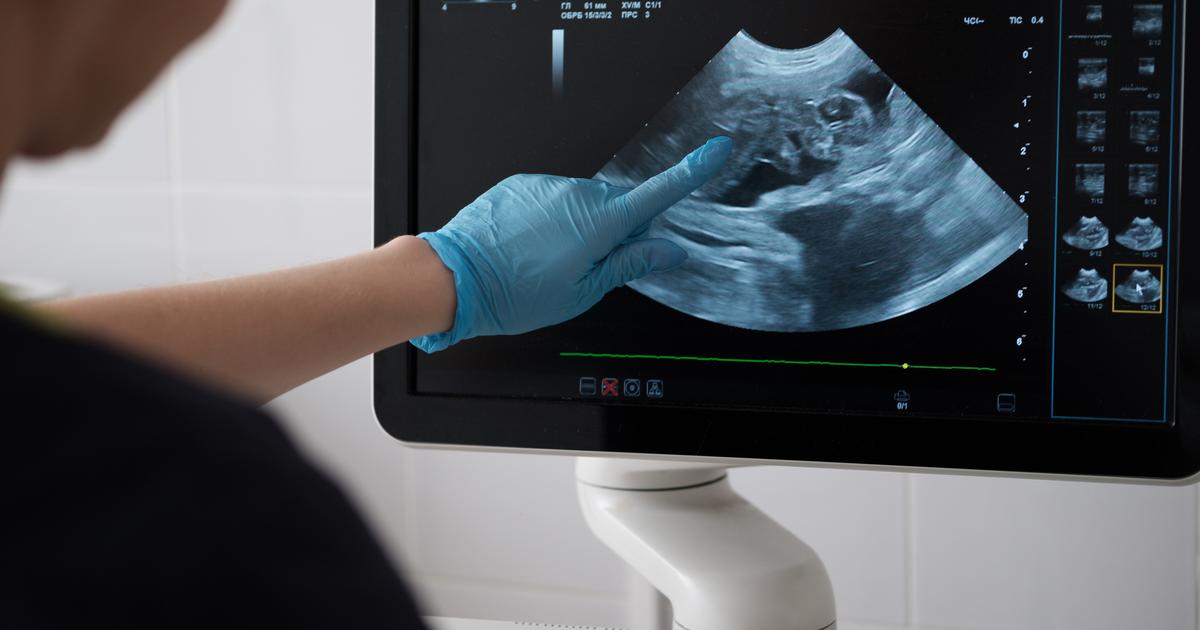 Yvelines : un voleur non identifié dérobe un échographe à 50.000 euros dans un centre hospitalier