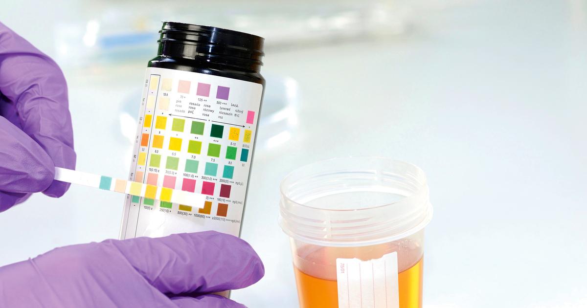 Analyse d’urine chez l’enfant : comment gagner jusqu’à dix ans d’espérance de vie en bonne santé