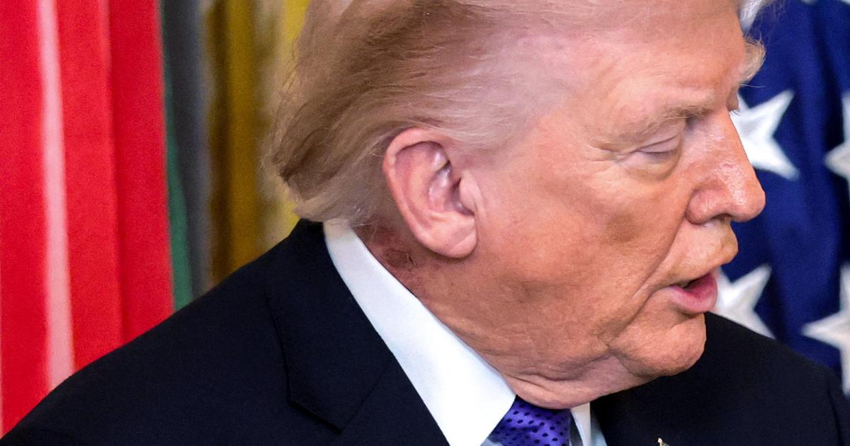 Une plaque rougeâtre aperçue dans le cou de Donald Trump lors d’une cérémonie à la Maison-Blanche
