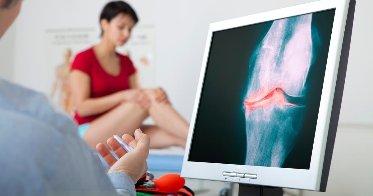 Arthrose du genou : une nouvelle voie thérapeutique ouverte par... les médicaments anti-obésité