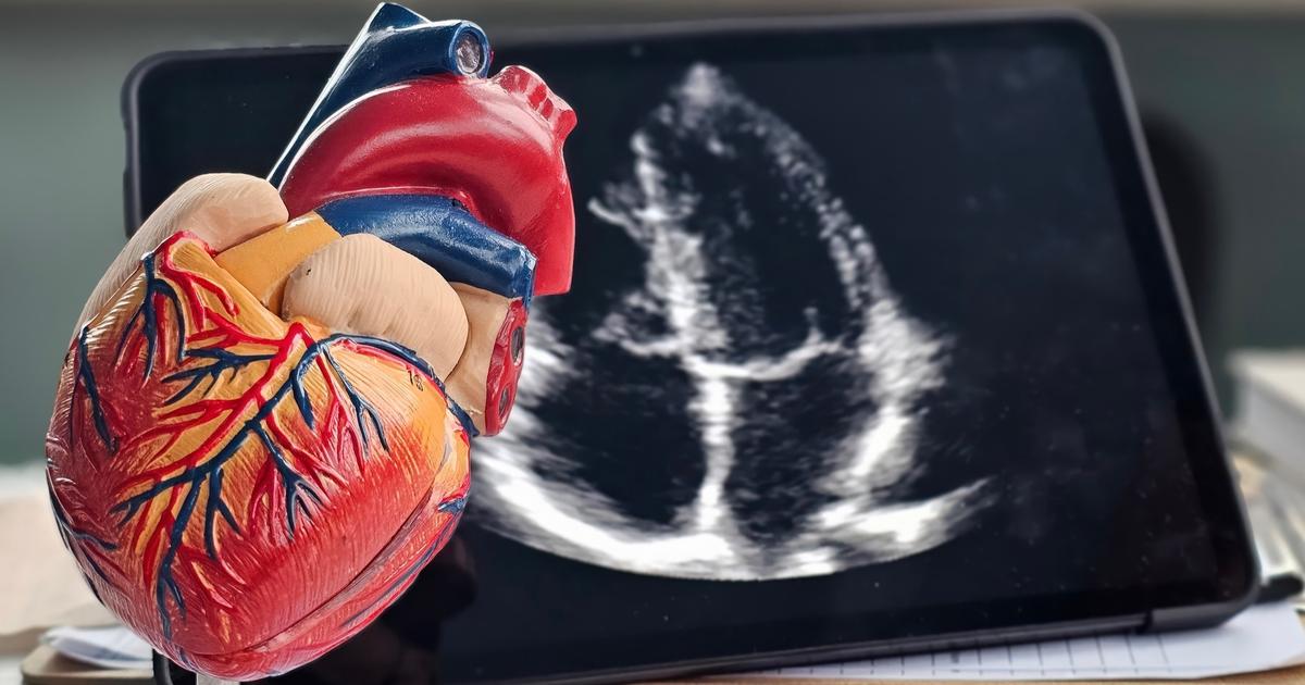 « Des patients sont morts d’une perforation d’organe » : le nicorandil, vingt ans d’alertes ignorées pour un médicament peu efficace