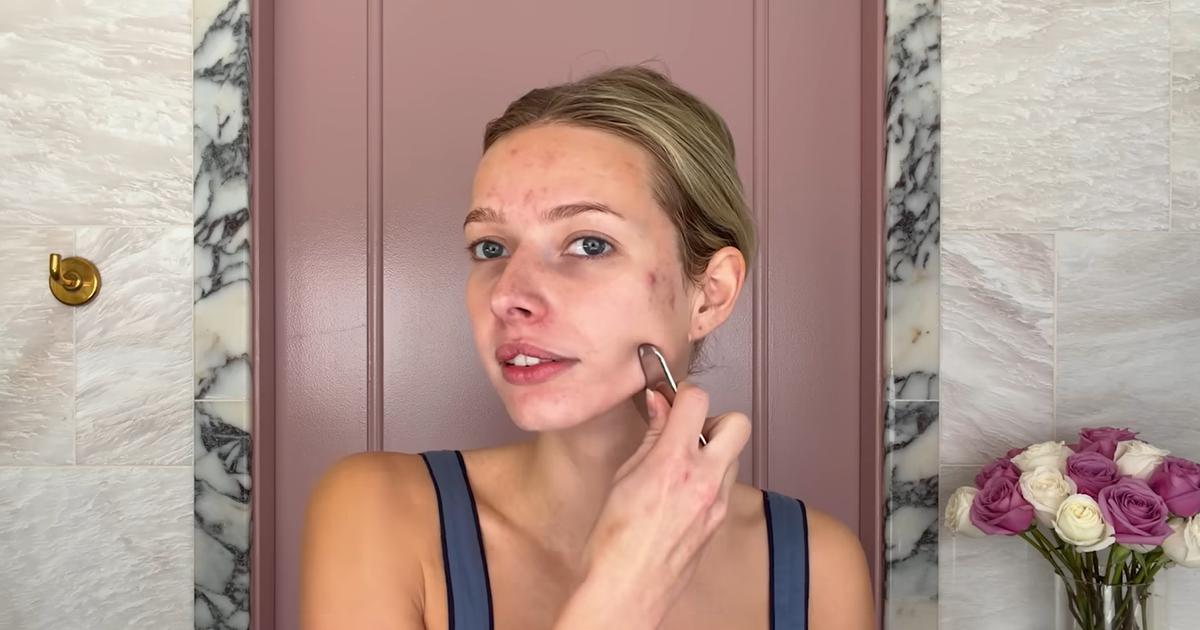 « L’acné n’est pas qu’un problème cutané, c’est un enjeu social » : ces boutons qui perturbent l’idéal de perfection de la Gen Z