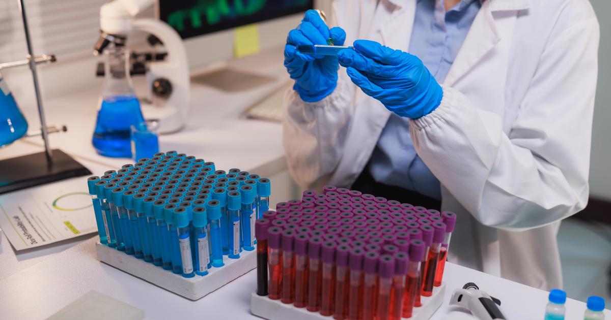 Appel à la grève dans les laboratoires de biologie médicale en ville le 4 mai