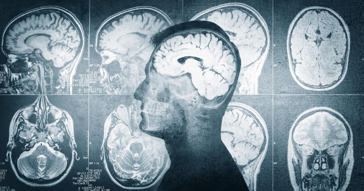 « C’est un dragon qui écrase tout sur son passage » : briser le silence autour du cancer du cerveau avec la campagne Mai en gris