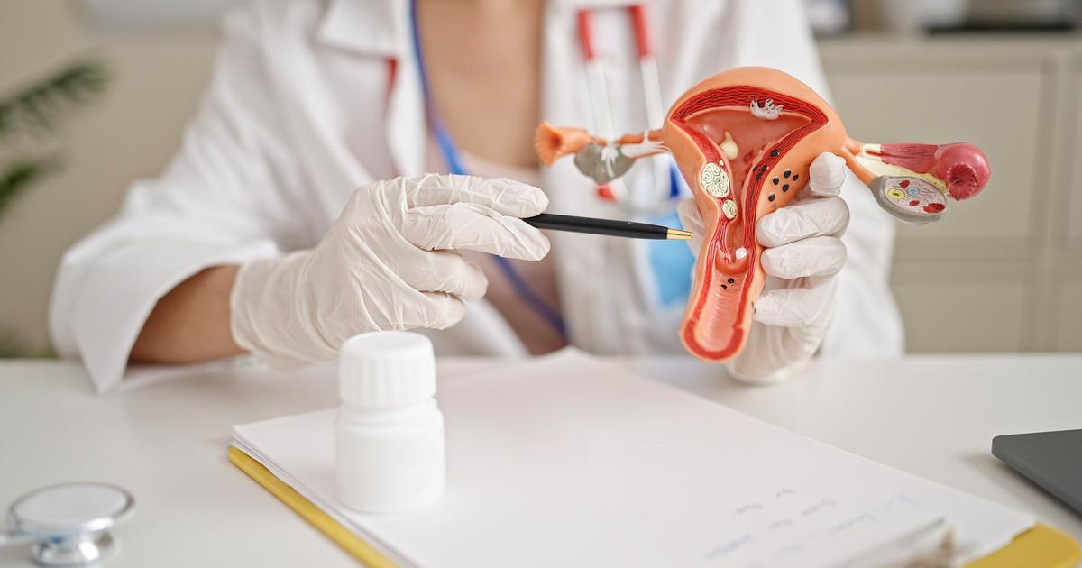 « Ce n’est pas un problème de kystes » : pourquoi vous ne souffrez officiellement plus du syndrome des ovaires polykystiques