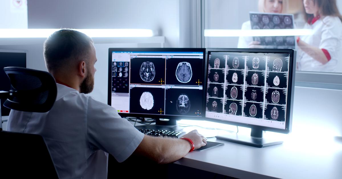 Cancer du poumon : le métabolisme du cerveau, un nouveau marqueur clé du pronostic