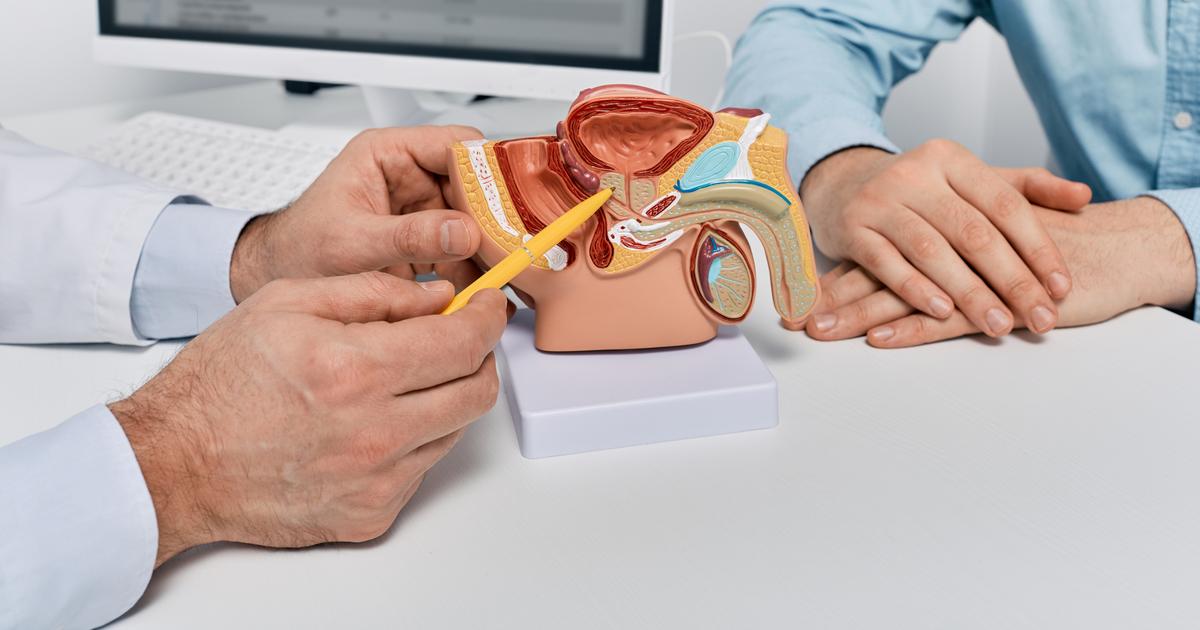 Cancer de la prostate : le dépistage systématique fait (un peu) baisser la mortalité