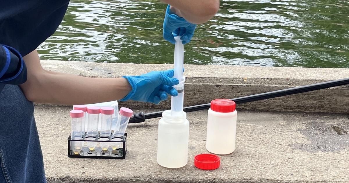 Peut-on vraiment se baigner en toute sécurité dans le canal Saint-Martin ? Le Figaro a fait analyser l’eau par des scientifiques indépendants