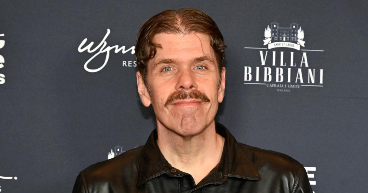 Le blogueur star Perez Hilton hospitalisé d’urgence après s’être automutilé en direct sur TikTok