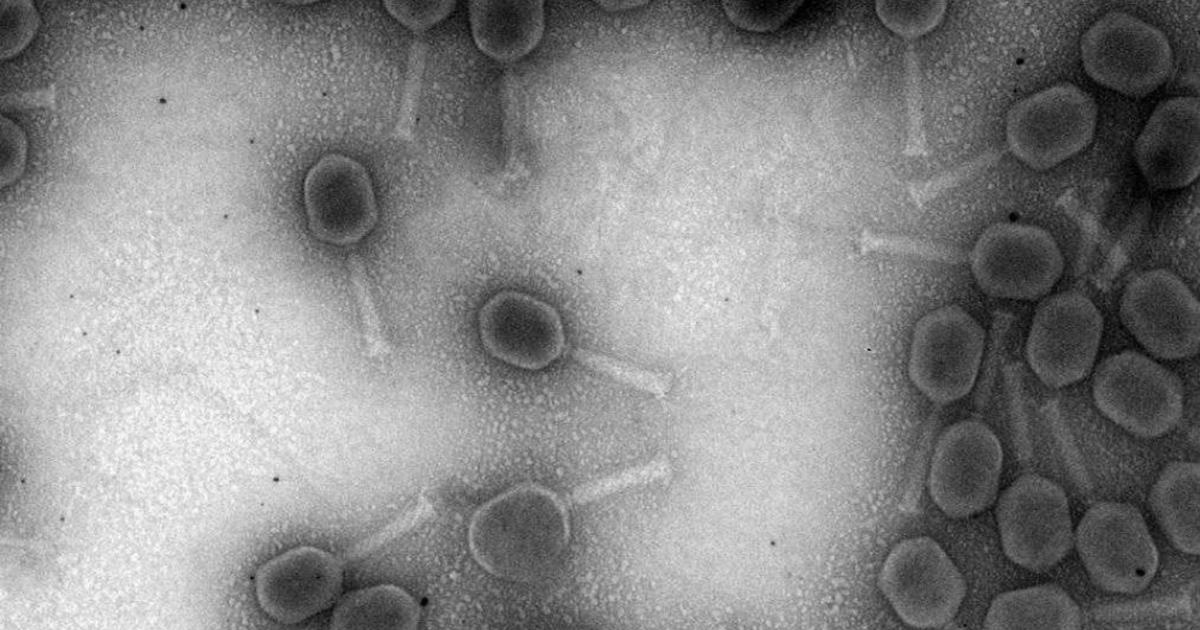 À Lyon, on élève des virus «mangeurs» de bactéries résistantes aux antibiotiques