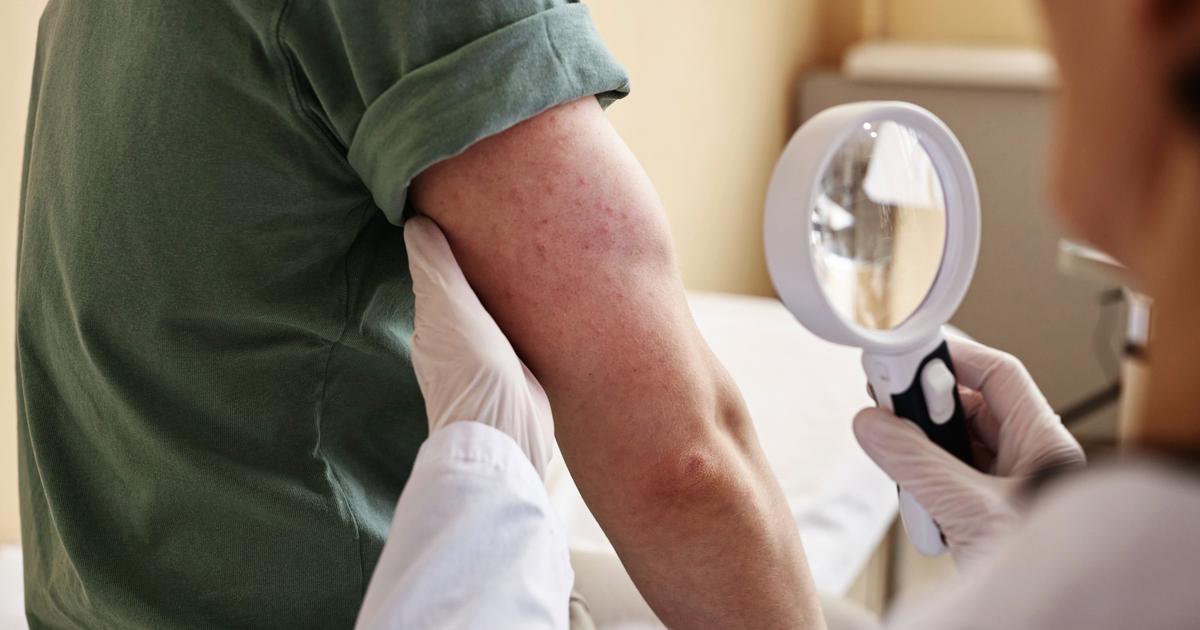 Cancer : mieux prendre en charge les effets indésirables pour améliorer la qualité de vie des patients