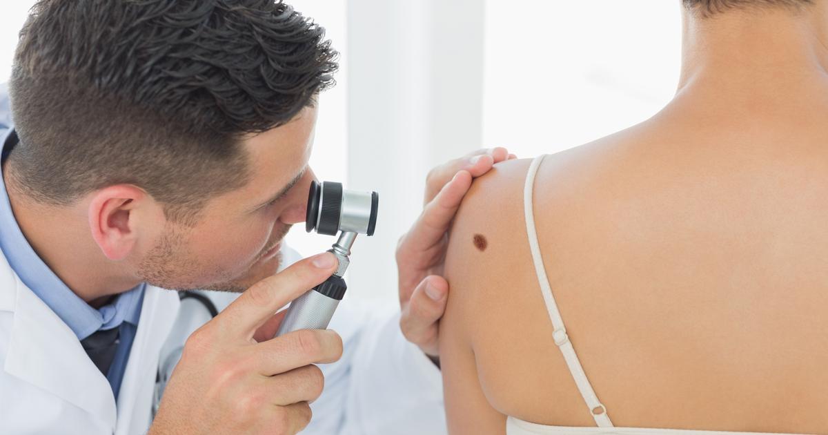 Premier succès prometteur d’un vaccin ARN contre le mélanome : à l’aube d’une révolution en cancérologie ?