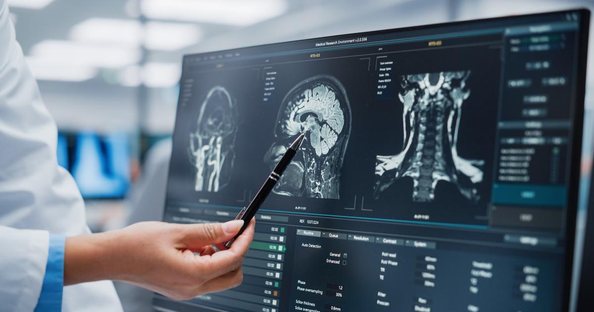 6,3 millions de cellules du cerveau à la loupe : des chercheurs dressent une carte inédite du cortex pour mieux comprendre les maladies cérébrales