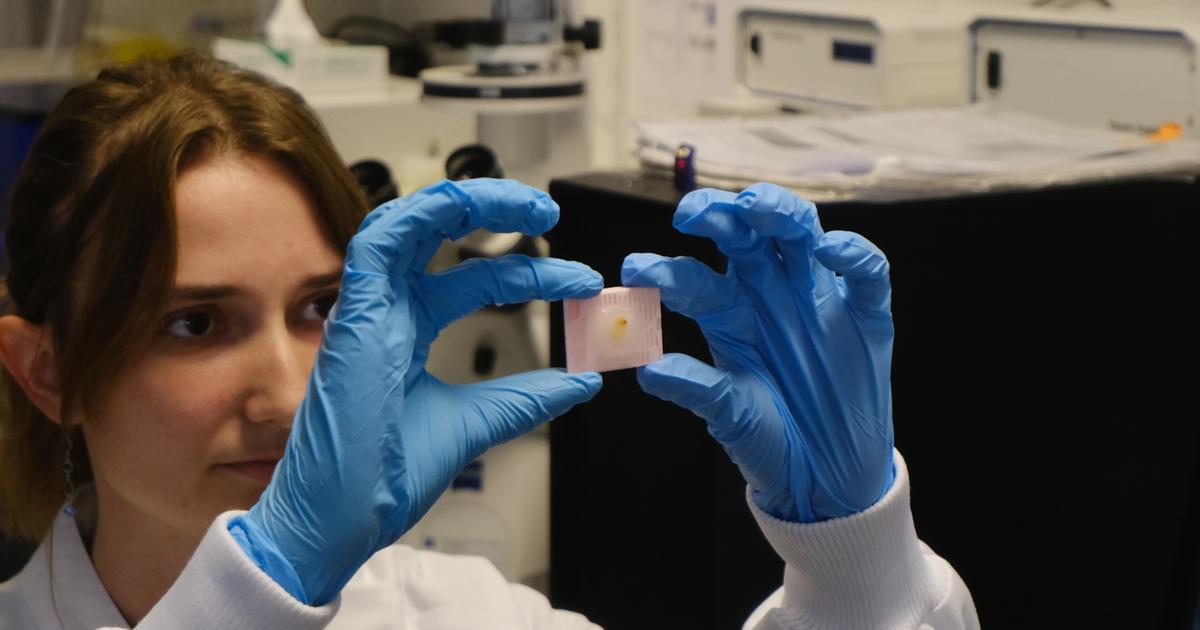 Atlas, organoïdes et robot : à Nantes, un projet de recherche Inserm pour mieux comprendre les cancers du sein chez la femme jeune