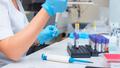 Un cluster de contaminations au VIH découvert en Auvergne-Rhône-Alpes
