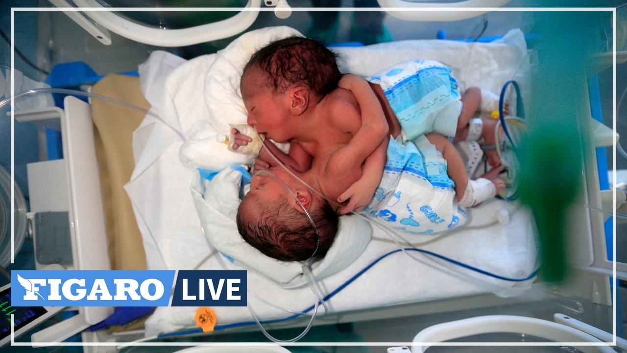 Deux Bebes Siamois Yemenites Hors De Danger Apres Leur Separation En Jordanie