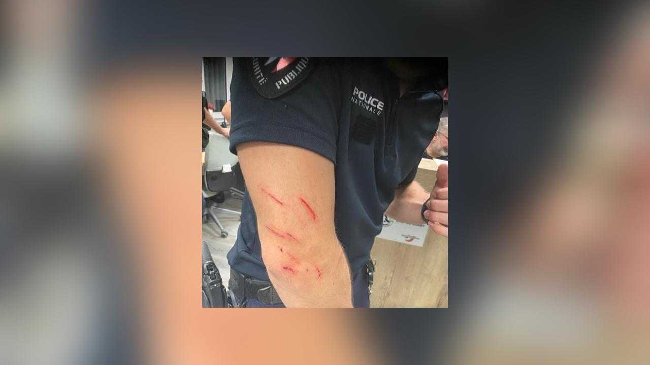 À Marseille, un policier en patrouille violemment agressé au couteau