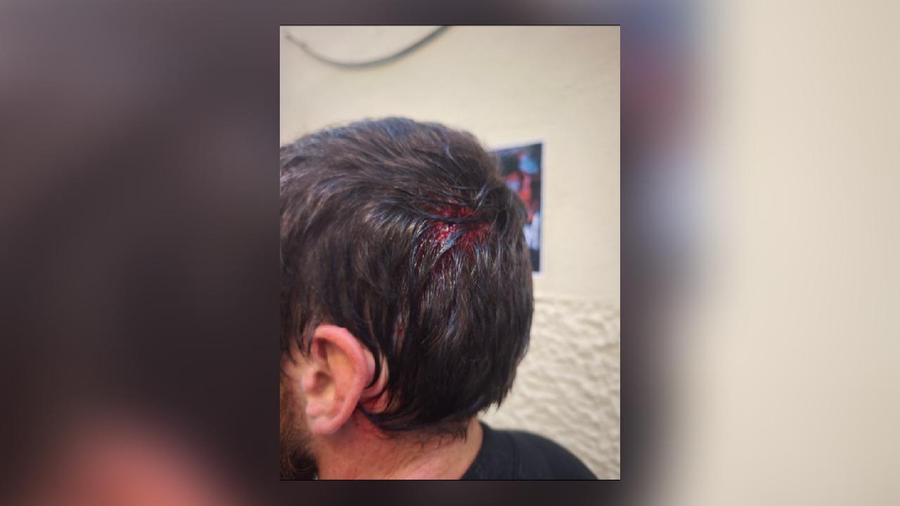 Marseille : un policier blessé à coups de marteau lors du mouvement lycéen