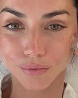 Quel est ce soin du visage Ă 1600 euros que les stars sâarrachent avant un Ă©vĂ©nement, pour un effet lifting sans chirurgie ?