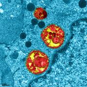 Coronavirus : l'image rare d'une cellule respiratoire infectée